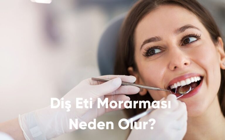 Diş Eti Morarması Neden Olur?